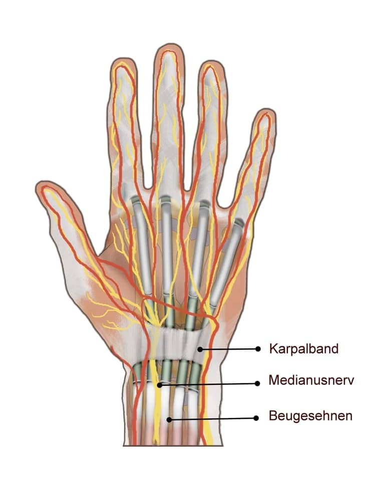 Carpal Tunnel Release Surgery 1
